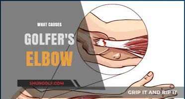 Golfer's Elbow: Causes and Prevention