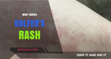 Golfer's Rash: Causes and Triggers