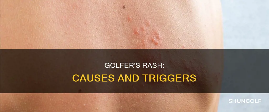what causes golfer