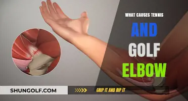 Understanding Tennis and Golf Elbow: Causes and Prevention