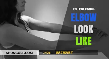 Golfer's Elbow: Visual Symptoms, Appearance, and Identification Guide