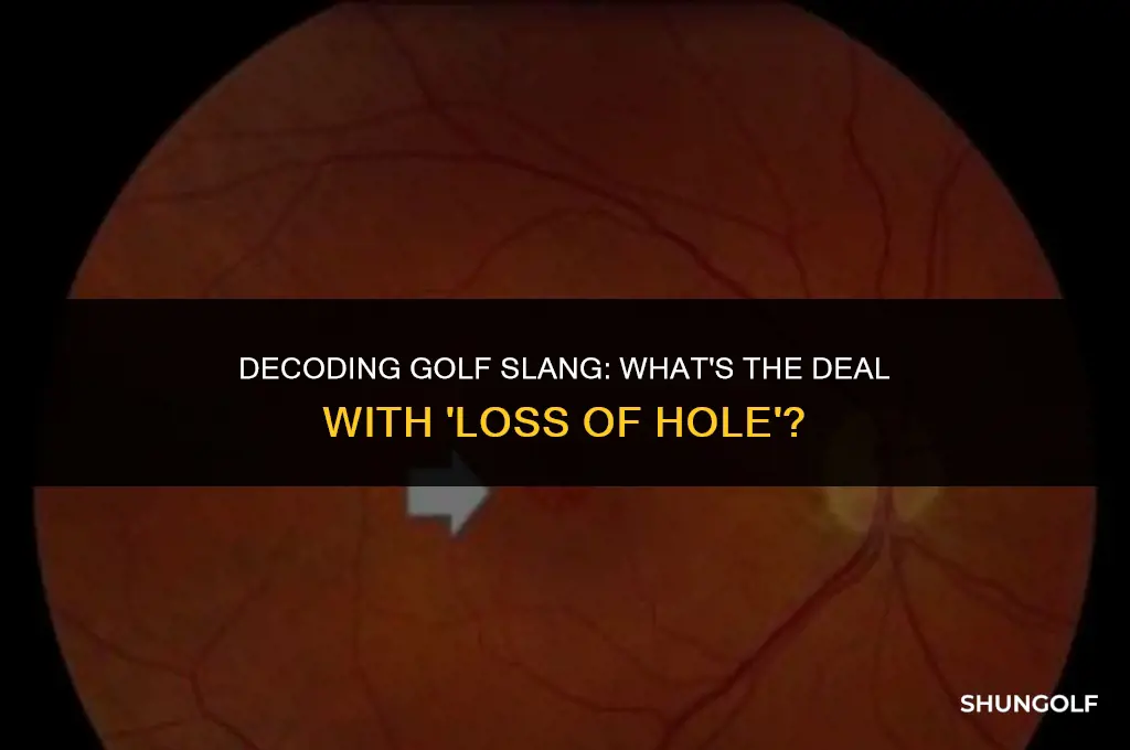 what does loss of hole mean in golf