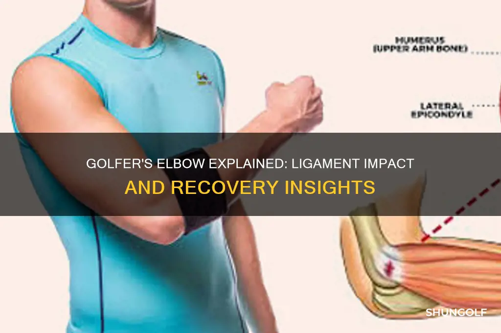 what happens to the ligament in golfer