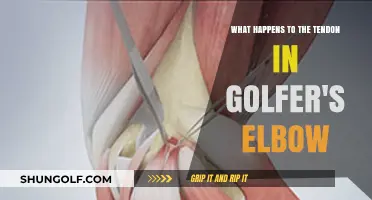 Golfer's Elbow Explained: Tendon Changes and Recovery Insights