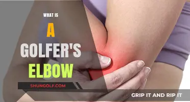 Understanding Golfer's Elbow: Causes, Symptoms, and Effective Treatment Options