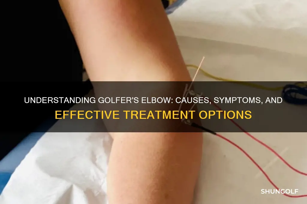 what is a golfer