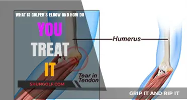 Golfer's Elbow Explained: Causes, Symptoms, and Effective Treatment Options