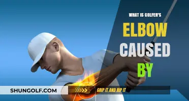 Understanding Golfer's Elbow: Causes and Contributing Factors Explained