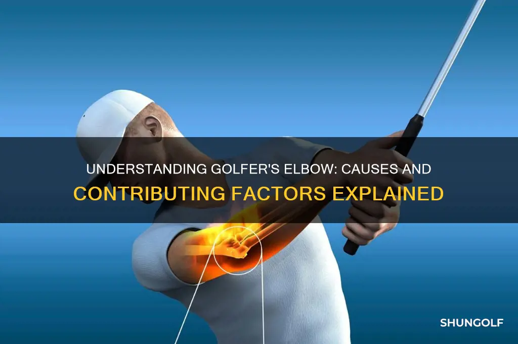 what is golfer