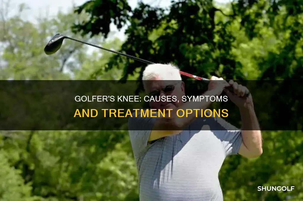 what is golfer