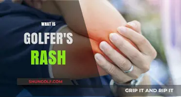 Golfer's Rash: Skin Irritation and Itchiness Explained