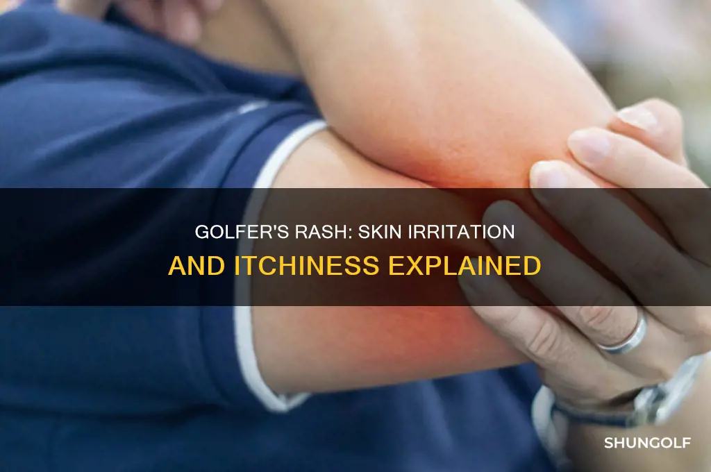 what is golfer