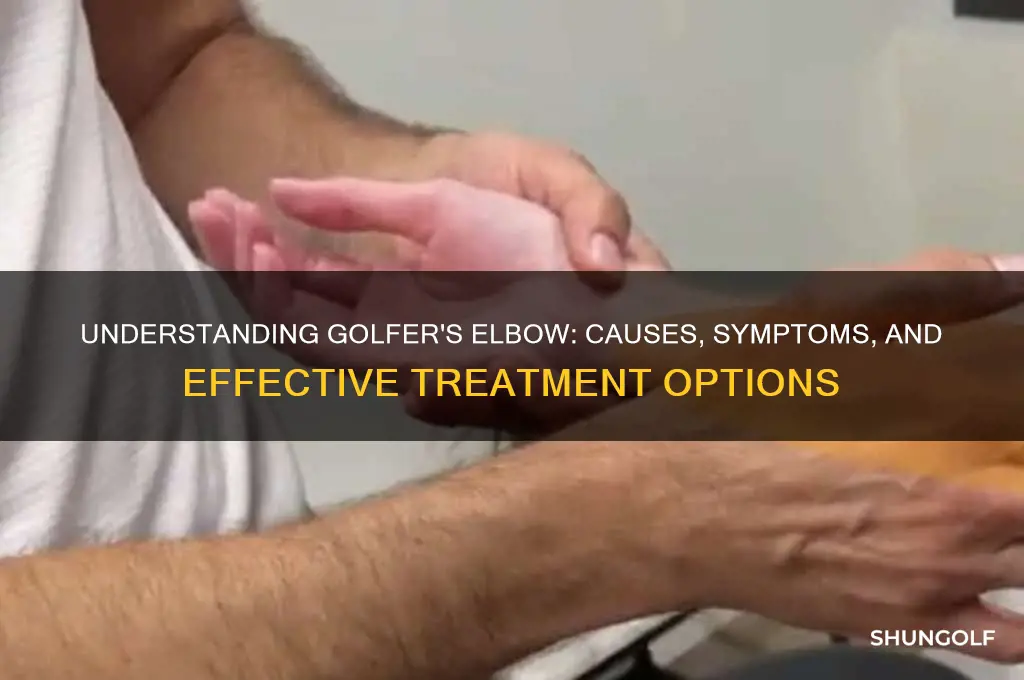what is the definition of golfer