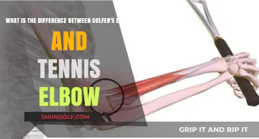 Golfer's Elbow vs. Tennis Elbow: Understanding the Key Differences