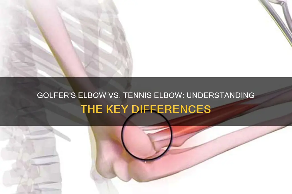what is the difference between golfer