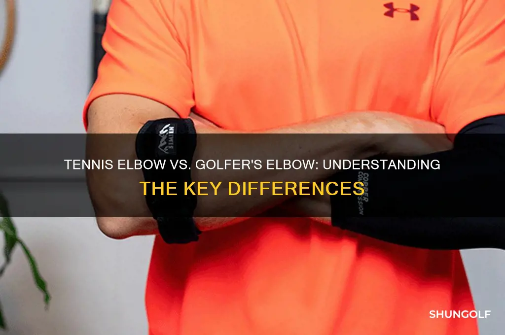 what is the difference between tennis elbow and golfer