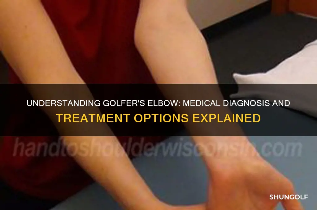 what is the medical diagnosis for golfer