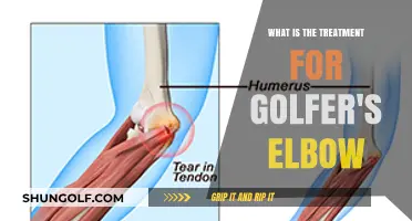 Effective Treatment Options for Golfer's Elbow: Relief and Recovery Guide