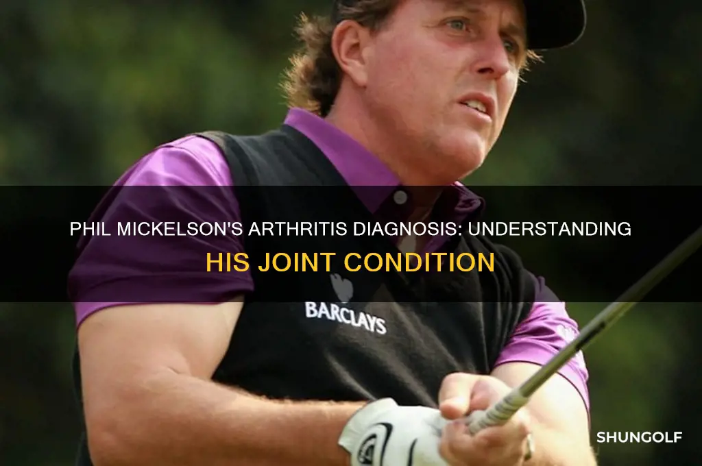 what kind of arthritis dose golfer phil nickerson hsve