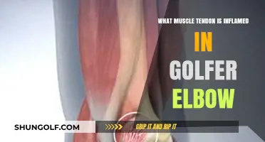 Golfer's Elbow: Understanding the Inflamed Muscle Tendon in Medial Epicondylitis