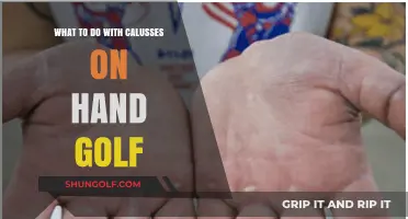 How to Treat and Prevent Golf Hand Calluses: Expert Tips