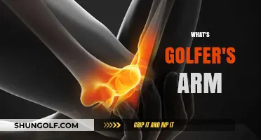 Golfer's Arm: How to Avoid This Painful Swing Problem