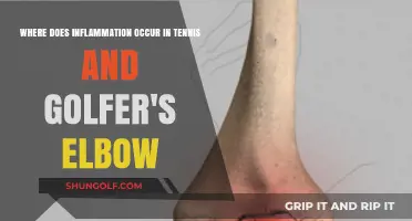 Understanding Inflammation in Tennis and Golfer's Elbow: Key Areas Explained