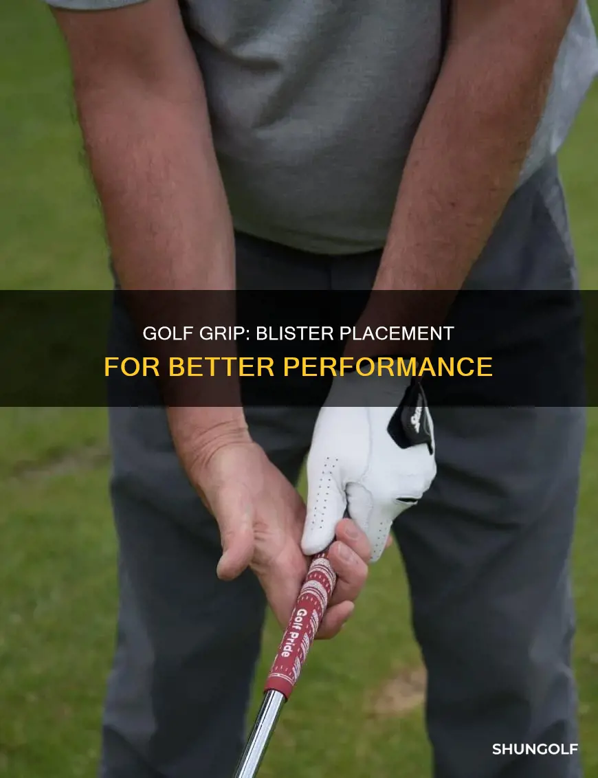 where should golf blisters be