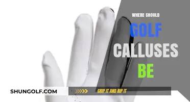 Golf Calluses: Where They Should Be Located