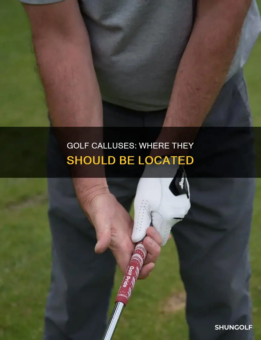 where should golf calluses be