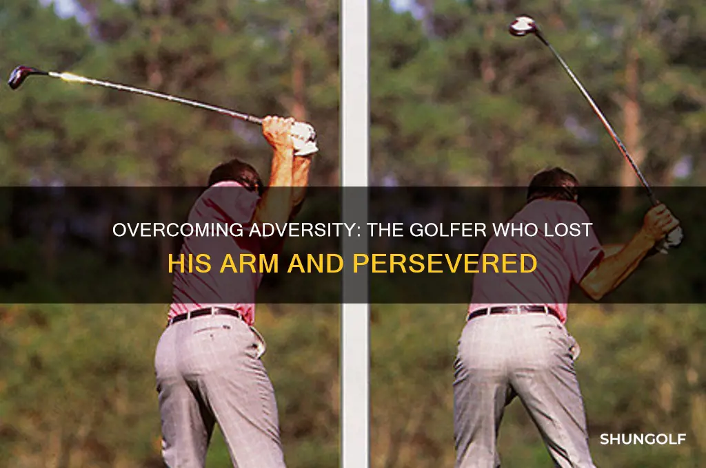 which golfer lost his arm