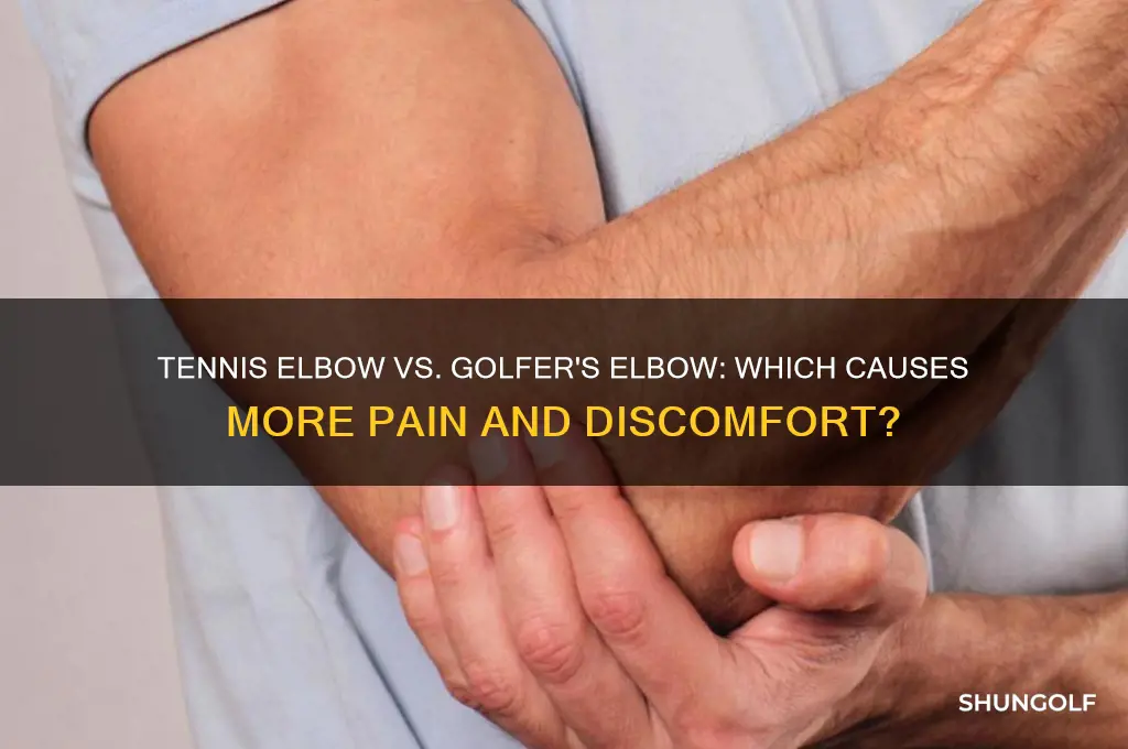 which is worse tennis elbow or golfer