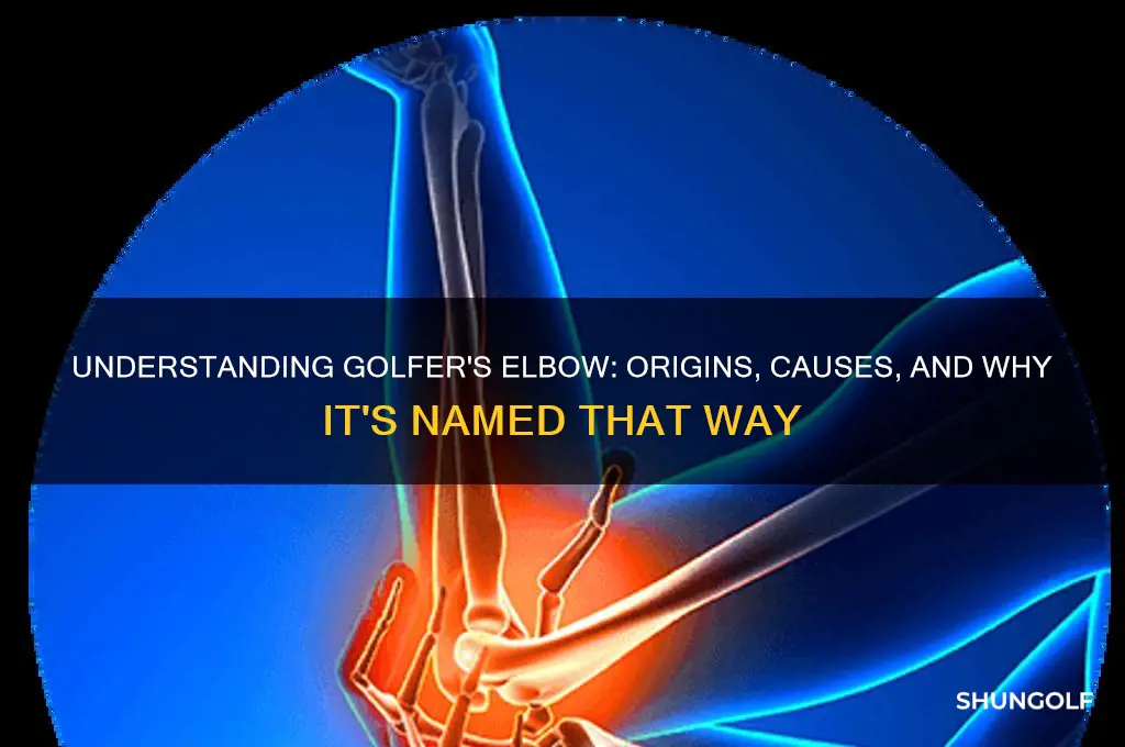 why is it called golfer