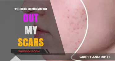 Golfing and Scar Tissue: Can Swinging Stretch Out Old Scars?
