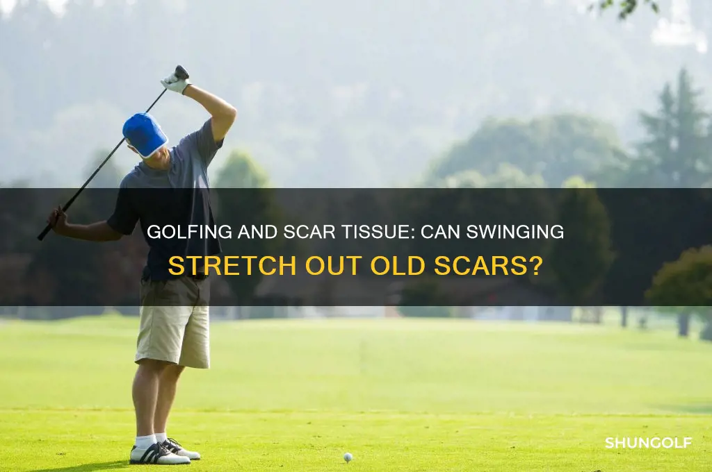 will going golfing stretch out my scars